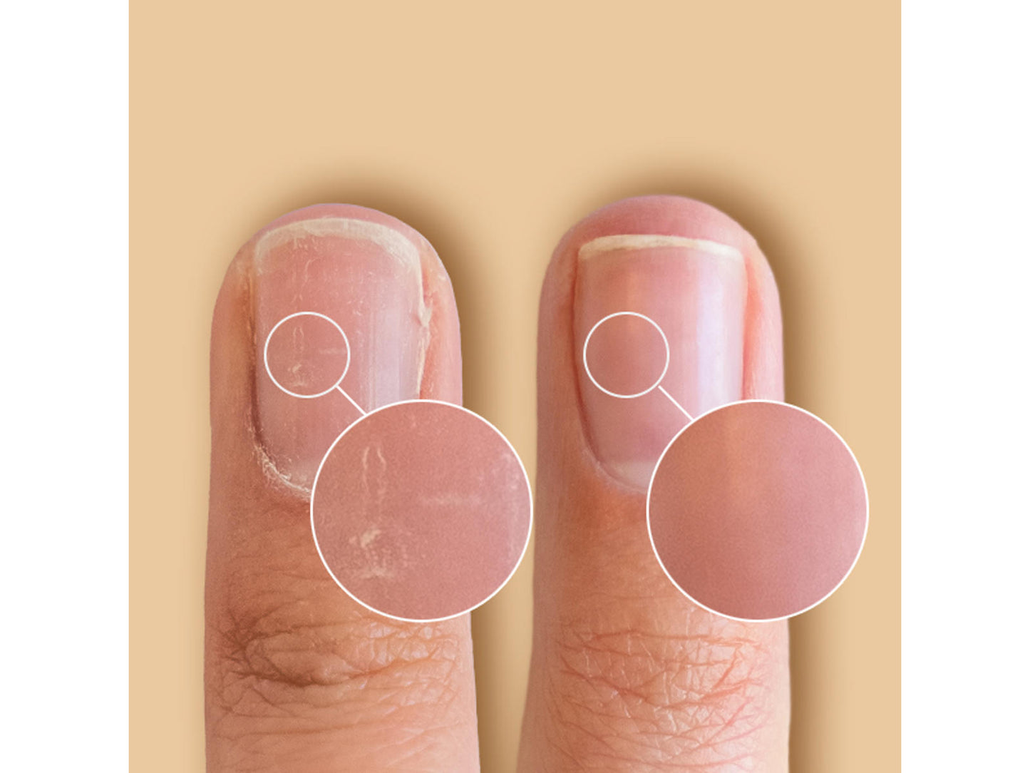 CND Solar Oil - Flere varianter