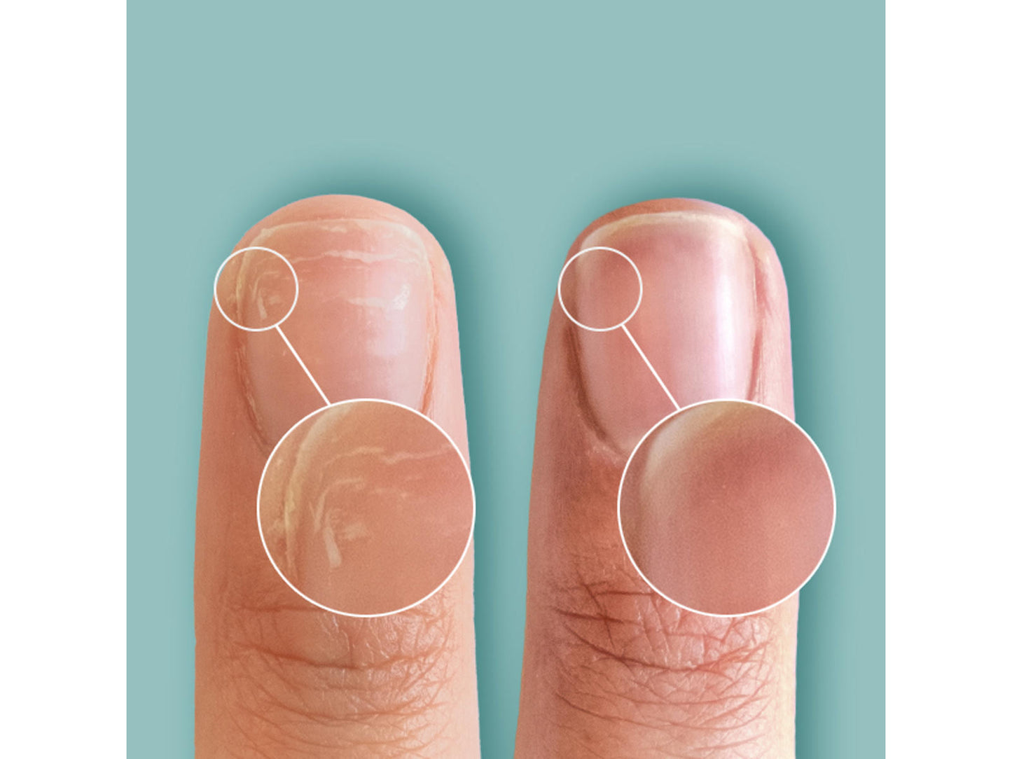 CND RescueRXx - flere varianter